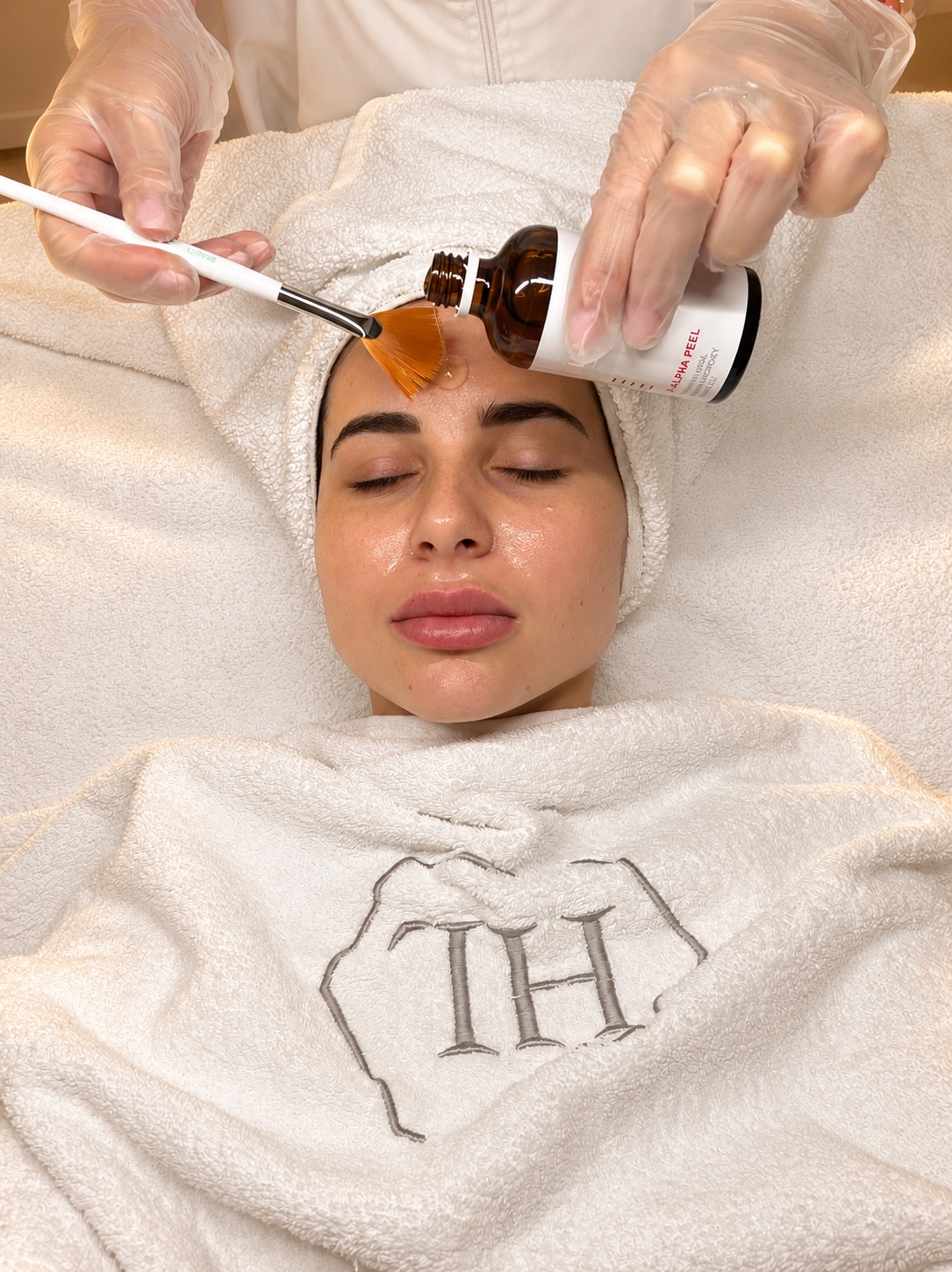 Applicazione di Alpha Peel · dettaglio